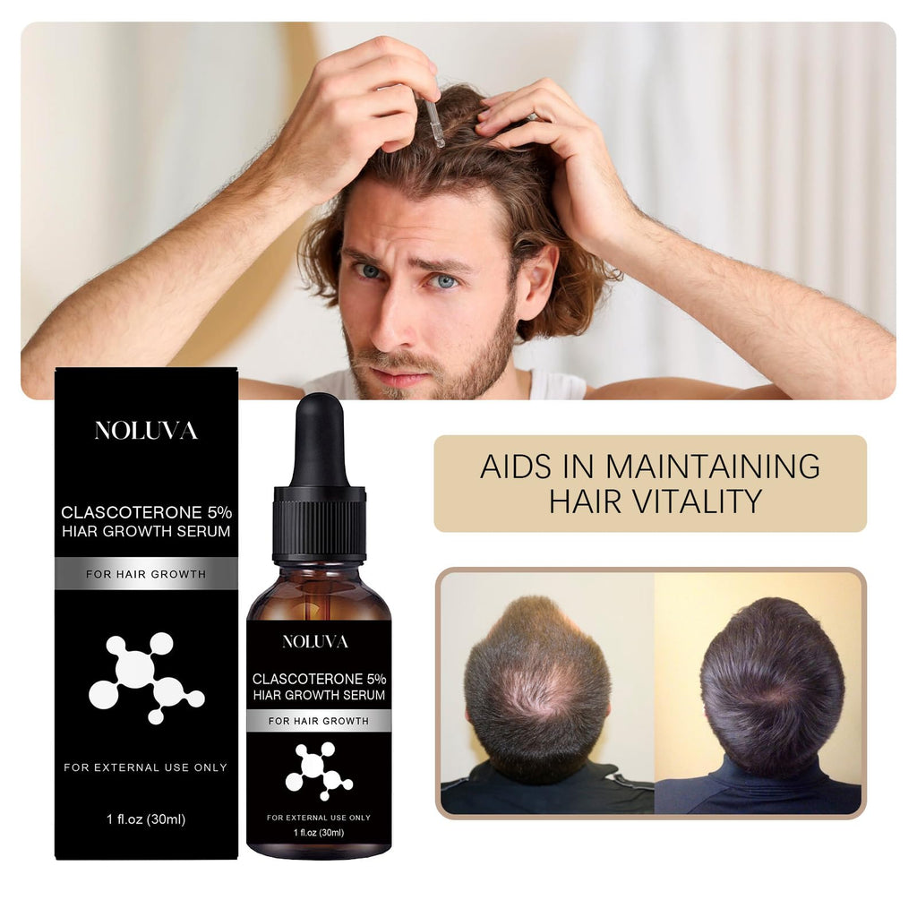 NOLUVA CLASCOTERONE 5% Hair Restoration Serum – Vitamin D, Minoxidil & Biotin (30ml)
