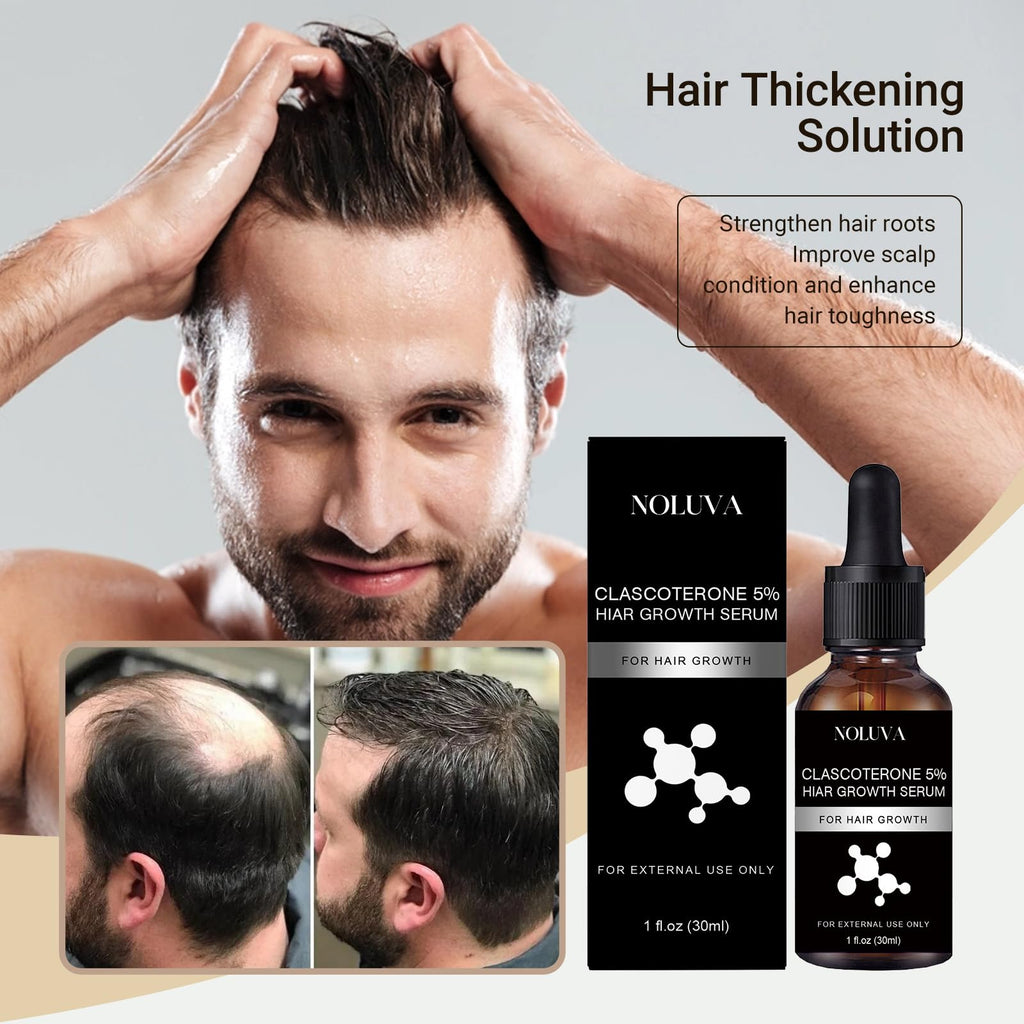 NOLUVA CLASCOTERONE 5% Hair Restoration Serum – Vitamin D, Minoxidil & Biotin (30ml)