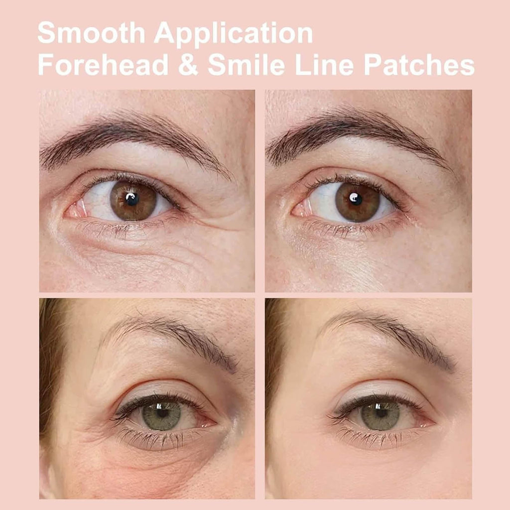 NOVALIFT Kunnozz Micro Eye Patches – Puffy Eyes, Dark Circles, Smile Lines & Forehead Hydration (2 Boxes)