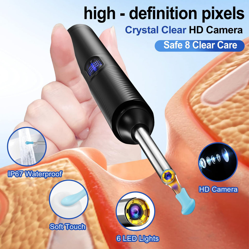 Ntgiso AI Eardrum Alert & Ear Wax Removal Kit — 1080P HD Otoscope Camera, 6-Axis Gyro, Waterproof Lens