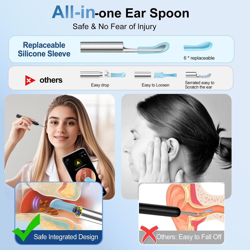 Ntgiso AI Eardrum Alert & Ear Wax Removal Kit — 1080P HD Otoscope Camera, 6-Axis Gyro, Waterproof Lens