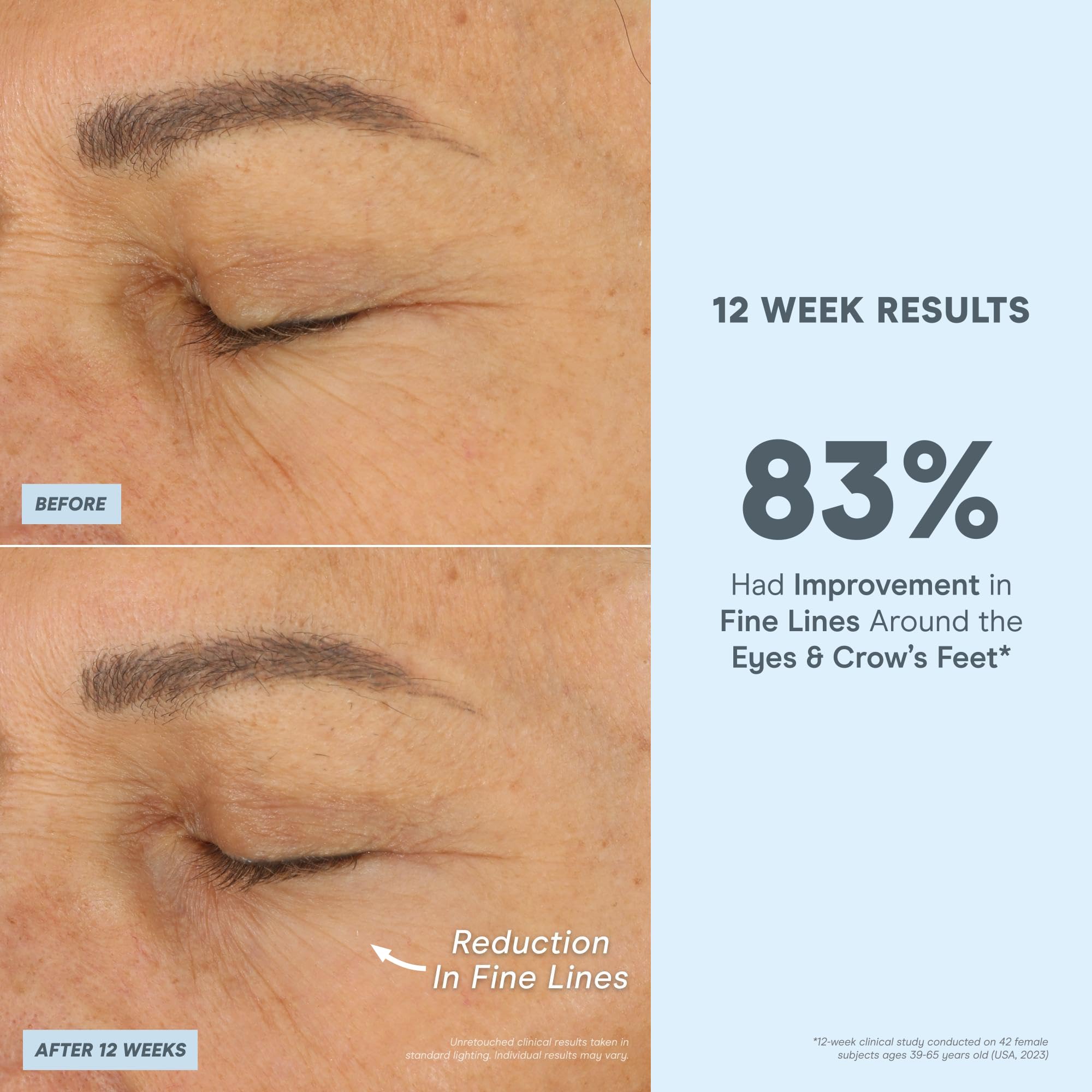 NuFACE Super Peptide Booster Face Serum | Firming, Hydration & IonPlex Prep for Microcurrent