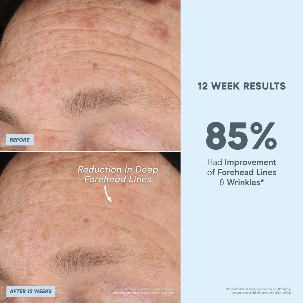 NuFACE Super Peptide Booster Face Serum | Firming, Hydration & IonPlex Prep for Microcurrent