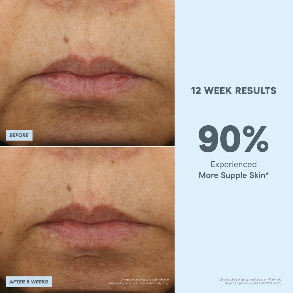 NuFACE Super Peptide Booster Face Serum | Firming, Hydration & IonPlex Prep for Microcurrent