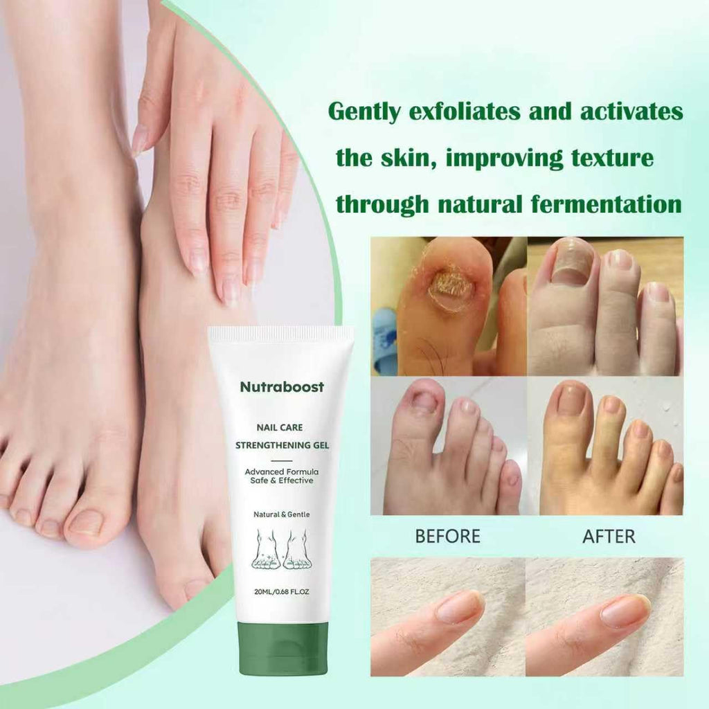 Nutraboost Natural Nail Care Gel – Strengthening Cuticle Serum for Damaged Nails, 20 ml (2-Pack)