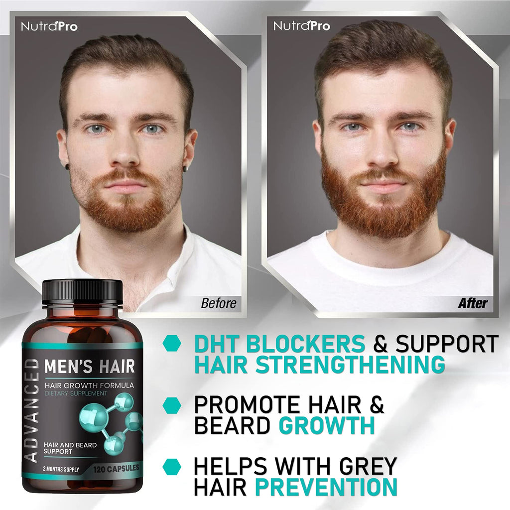 NutraPro Hair Growth Vitamins for Men – Anti Hair Loss Pills, Regrow Hair & Beard Support | 120 Caps