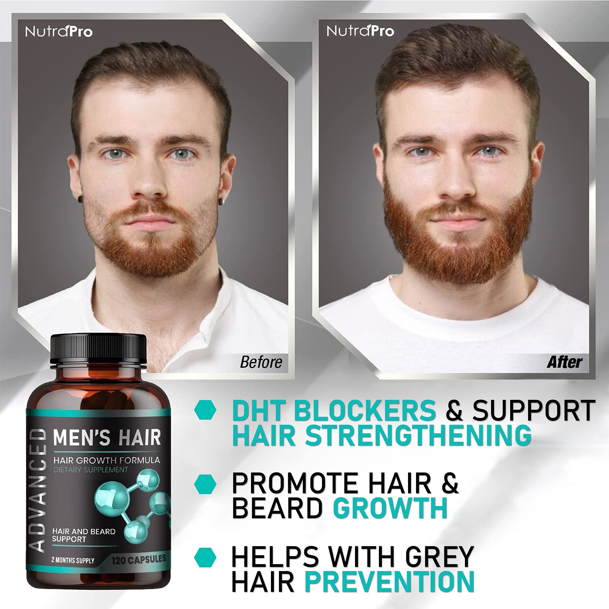 NutraPro Hair Growth Vitamins for Men – Anti Hair Loss Pills, Regrow Hair & Beard Support | 120 Caps