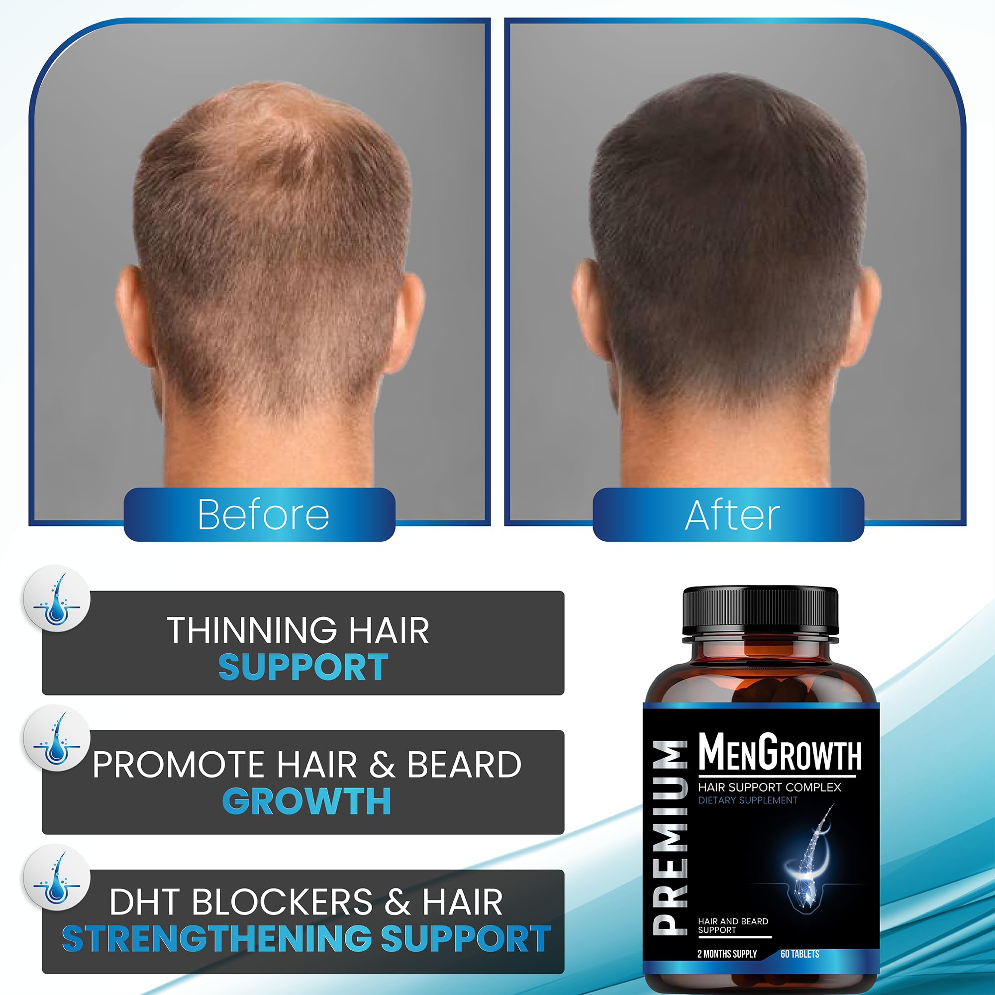 NutraPro MenGrowth Hair Growth Vitamins for Men – Biotin, Saw Palmetto & DHT Blocker