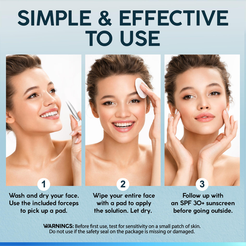 NUVADERMIS 35% Glycolic Peel Pads – Gentle Exfoliation for Clearer Skin (60 Double-Sided Pads)