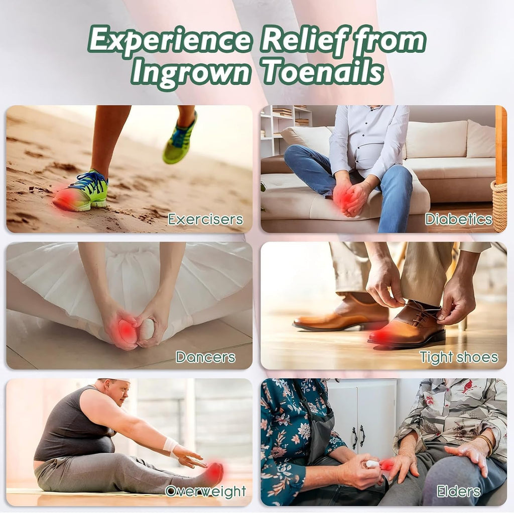 NWAKRD Ingrown Toenail Treatment Kit – 30ml Softening & Conditioning with Silicone Gel Toe Caps