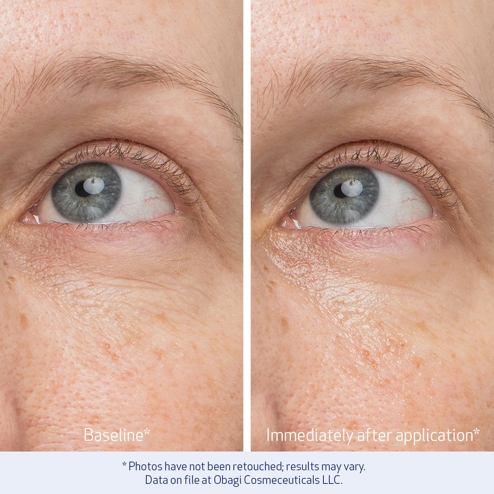 Obagi Daily Hydro-Drops Rejuvenating Eye Gel Cream – Brighten, De-Puff, Hydrate Under-Eyes (0.5 oz) | Obagi Medical