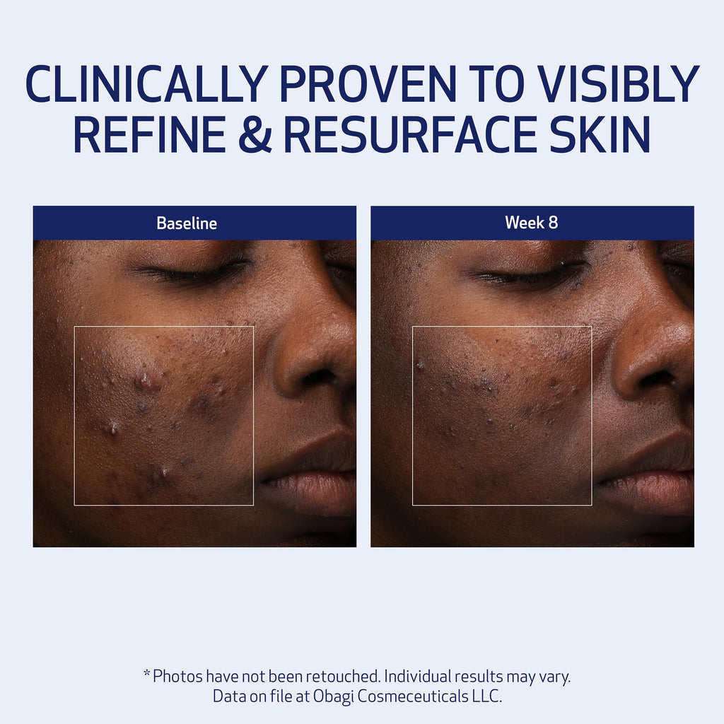 Obagi Medical Retinol + PHA Refining Night Cream – Overnight Anti-Aging, Smoother Skin & Even Complexion | 1.7 oz