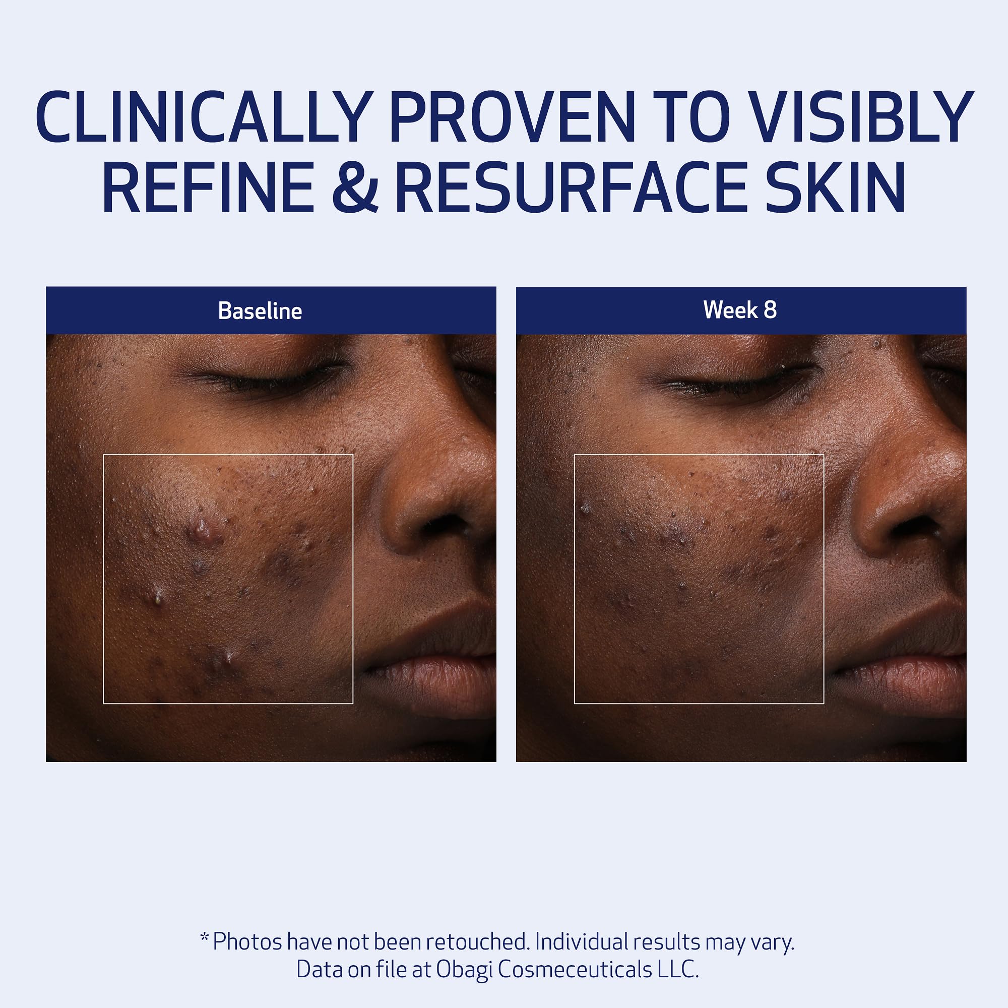 Obagi Medical Retinol + PHA Refining Night Cream – Overnight Anti-Aging, Smoother Skin & Even Complexion | 1.7 oz