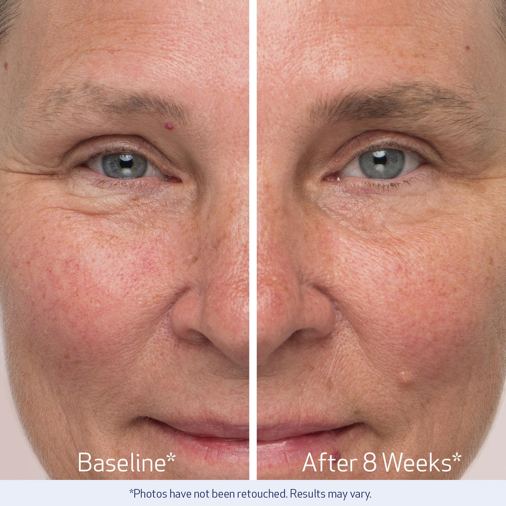 Obagi Nu-Cil Eyebrow Boosting Serum – Pack of 2 | Fuller Brows Over Time