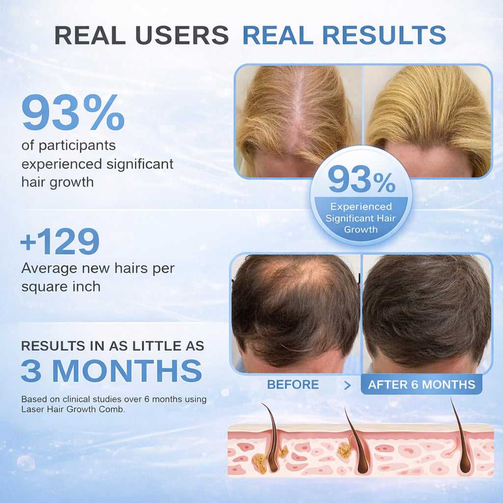 Obiredk Laser Hair Growth Comb - White | At-Home LLLT for Hair Growth