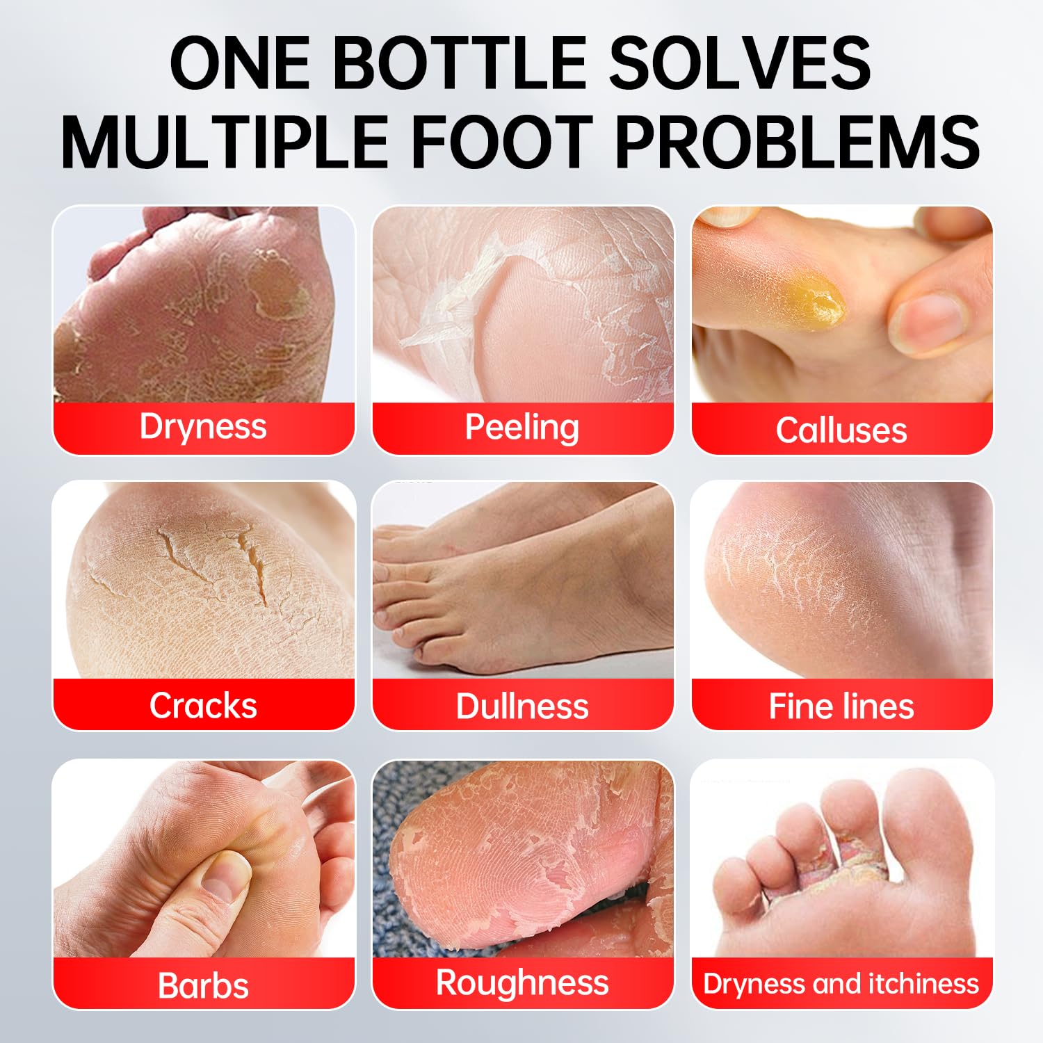 OCSINL Urea Cream 40% for Feet – Deep Repair, Moisture & Free Heel Covers (5.29 oz)