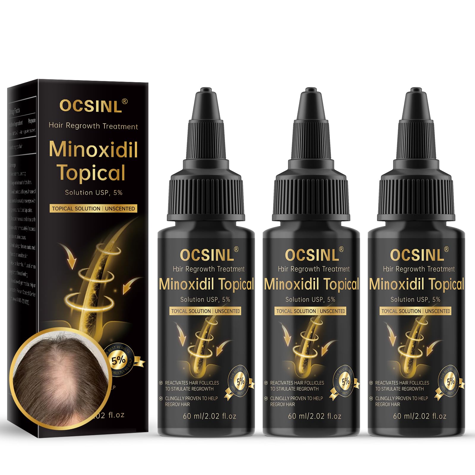 OCSINL 5% Minoxidil for Hair Regrowth — Biotin, Rosemary & Batana Oil (3-Pack)