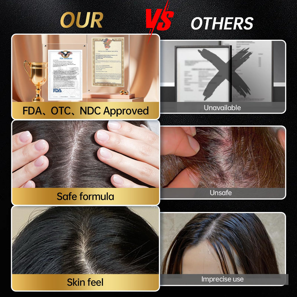 OCSINL Minoxidil 5% Serum + Massager Set for Men & Women – Hair Regrowth Solution with Biotin, Rosemary & Batana Oil (60ml)