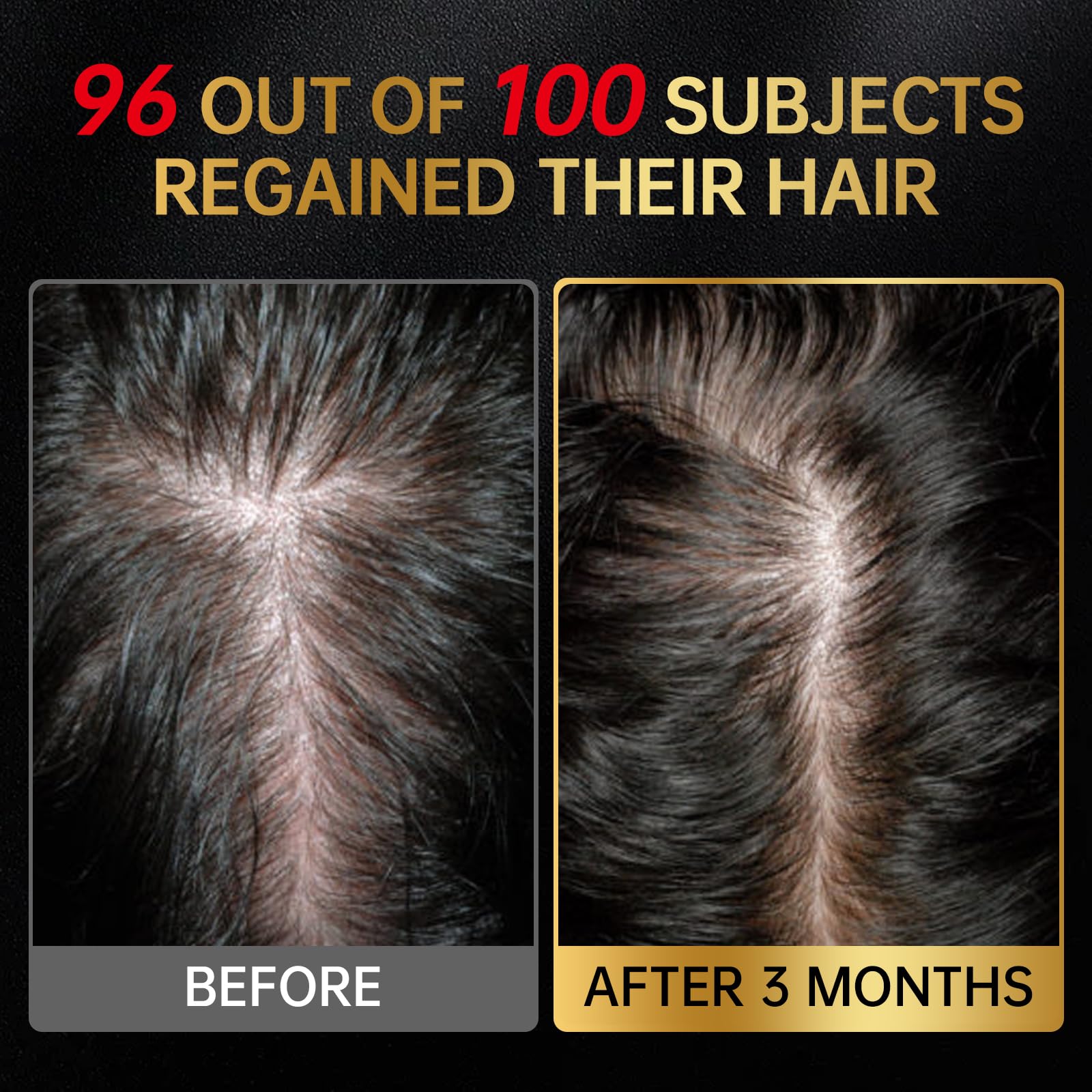 OCSINL 5% Minoxidil for Hair Regrowth — Biotin, Rosemary & Batana Oil (3-Pack)