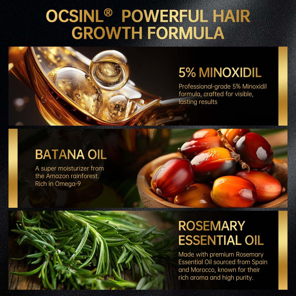 OCSINL 5% Minoxidil for Hair Regrowth — Biotin, Rosemary & Batana Oil (3-Pack)