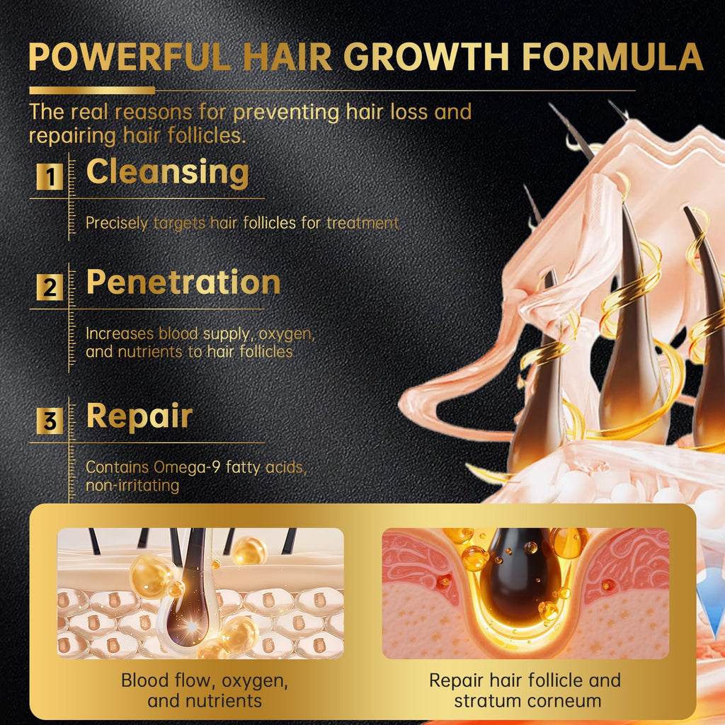 OCSINL 5% Minoxidil for Hair Regrowth — Biotin, Rosemary & Batana Oil (3-Pack)