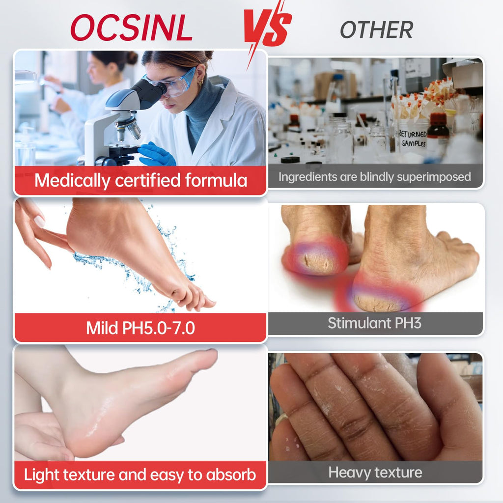 OCSINL Urea Cream 40% for Feet – Deep Repair, Moisture & Free Heel Covers (5.29 oz)