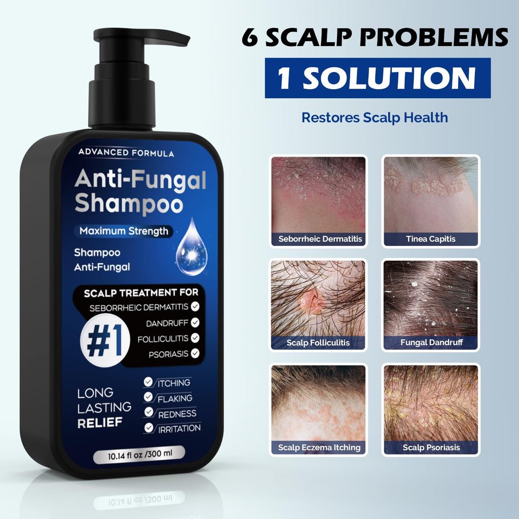 Oely Anti-Dandruff Shampoo for Folliculitis & Scalp Psoriasis | 10.1 fl oz