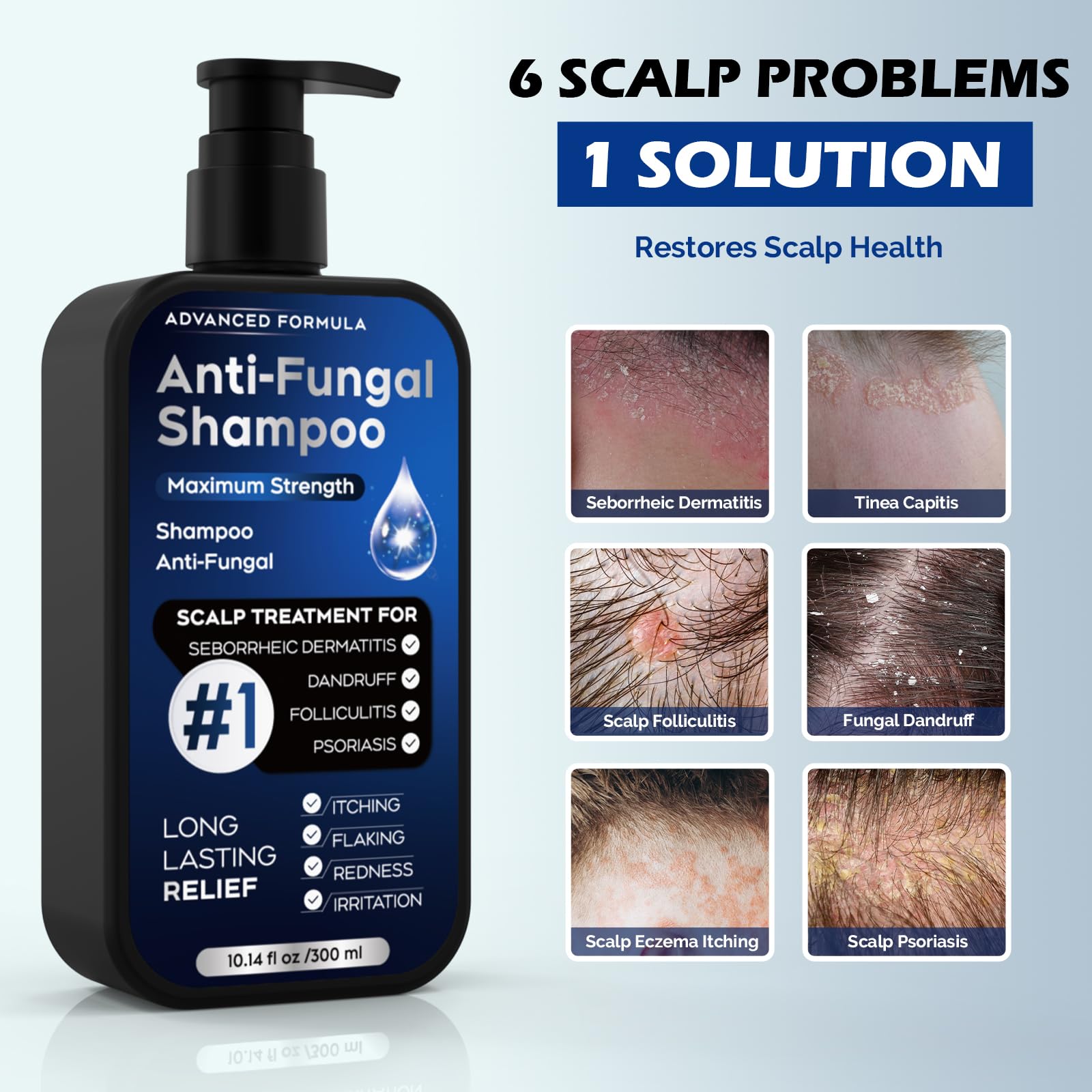 Oely Anti-Dandruff Shampoo for Folliculitis & Scalp Psoriasis | 10.1 fl oz