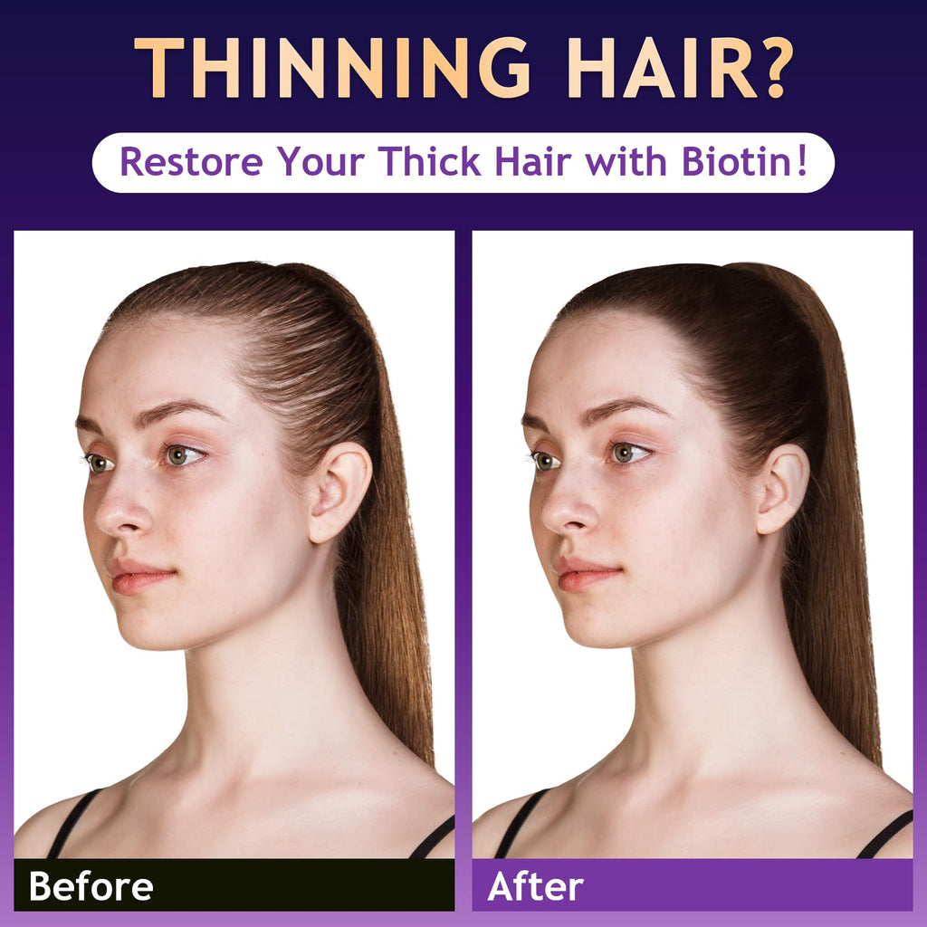 Oely Biotin Hair Growth & Thickening Shampoo – Root Activator, Sulfate-Free