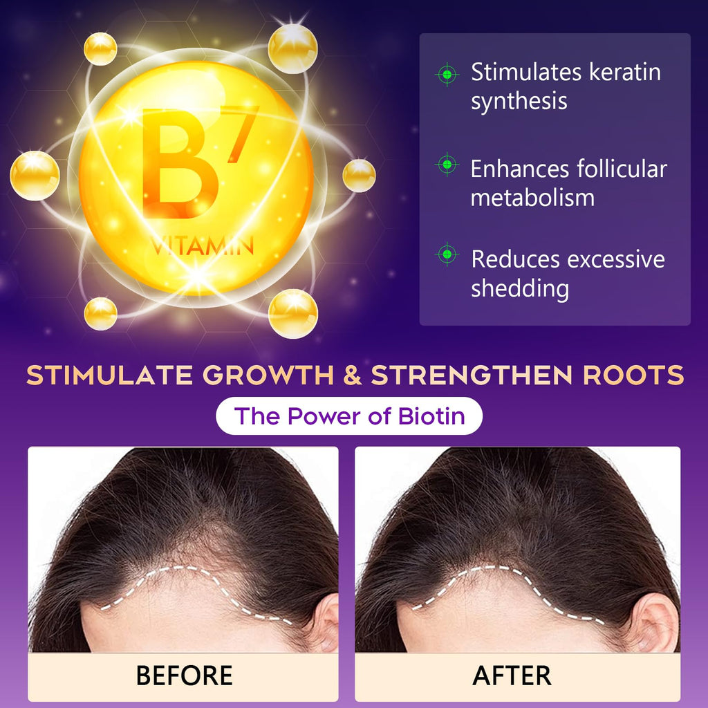 Oely Biotin Hair Growth & Thickening Shampoo – Root Activator, Sulfate-Free