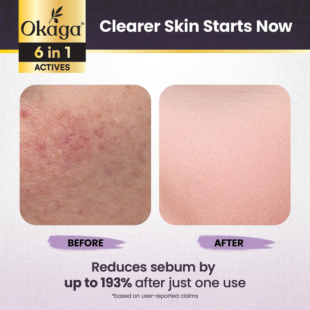 Okaga Black Rice Exfoliant Shot Ampoule – Pore Refining & Hydrating (90 mL)