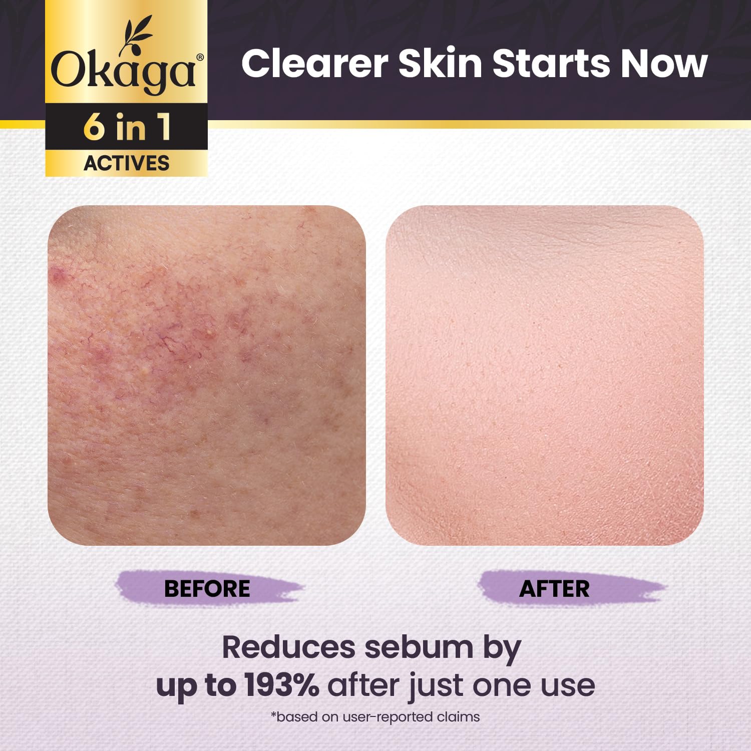 Okaga Black Rice Exfoliant Shot Ampoule – Pore Refining & Hydrating (90 mL)