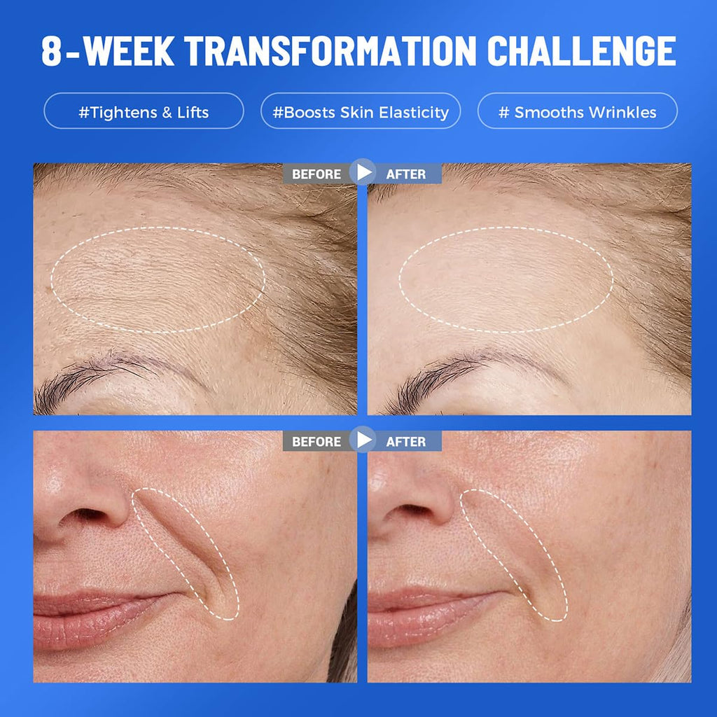 Okela 7-Pack Collagen Hydrogel Masks – Overnight Hydration, Firming & Brightening