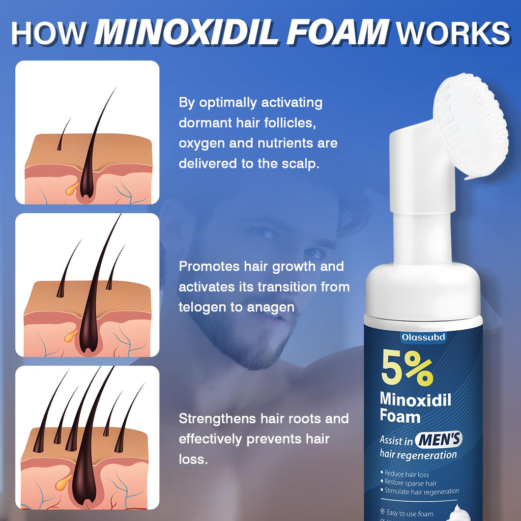 Olassubd Minoxidil 5% Foam for Men – Hair Growth Foam (3 Bottles, 2.11 oz Each)