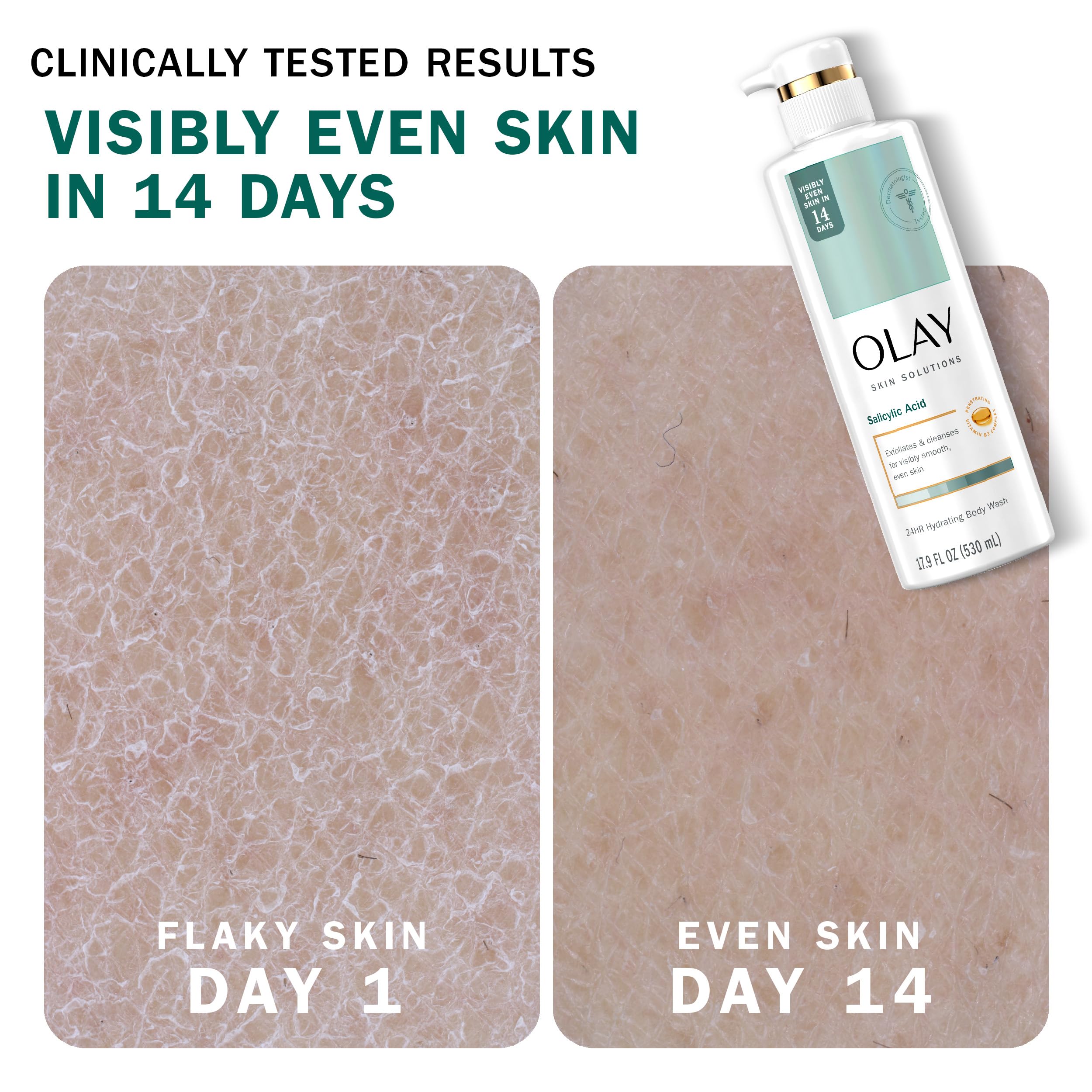 Olay Skin Solutions Hydrating Body Wash with Salicylic Acid – 4 x 17.9 fl oz