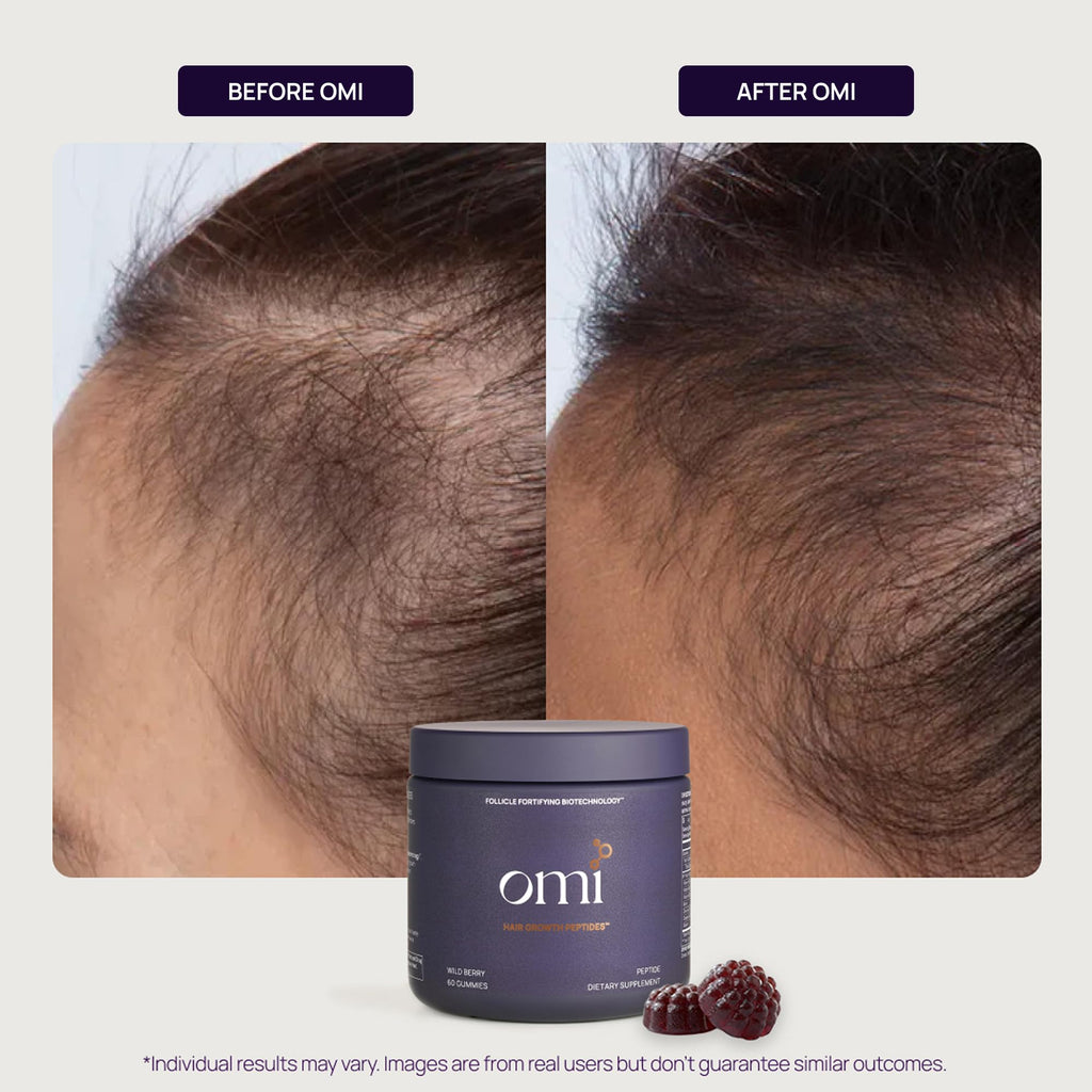 OMI WELLBEAUTY Hair Growth Peptides Gummies – Doctor Recommended, Patented Follicle Fortifying Biotech