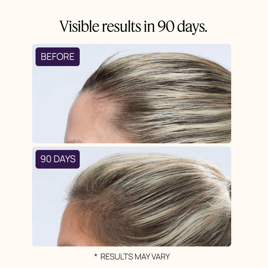 OMI WellBeauty Women's Hair Growth Peptides – Follicle Fortifying Biotechnology
