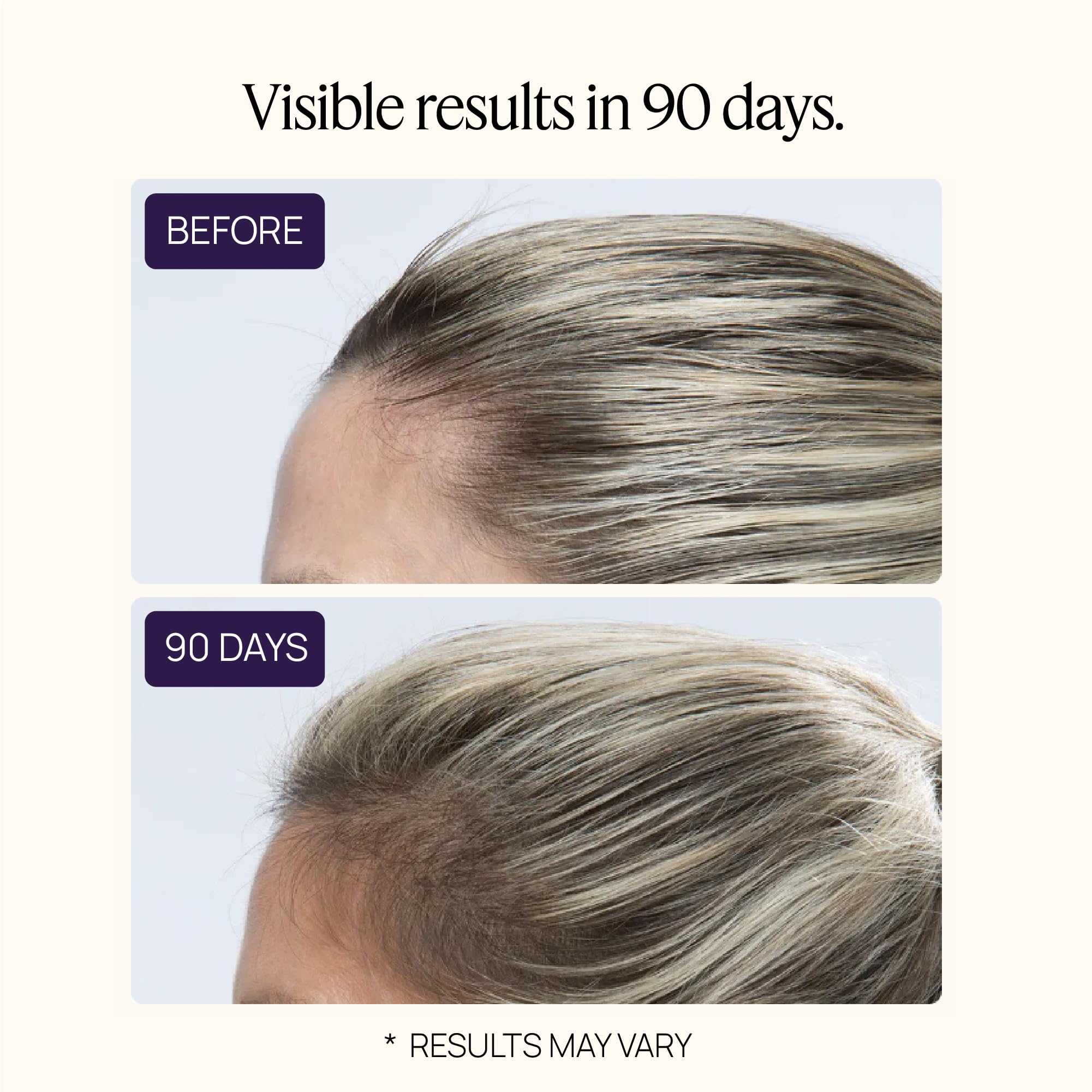 OMI WellBeauty Women's Hair Growth Peptides – Follicle Fortifying Biotechnology
