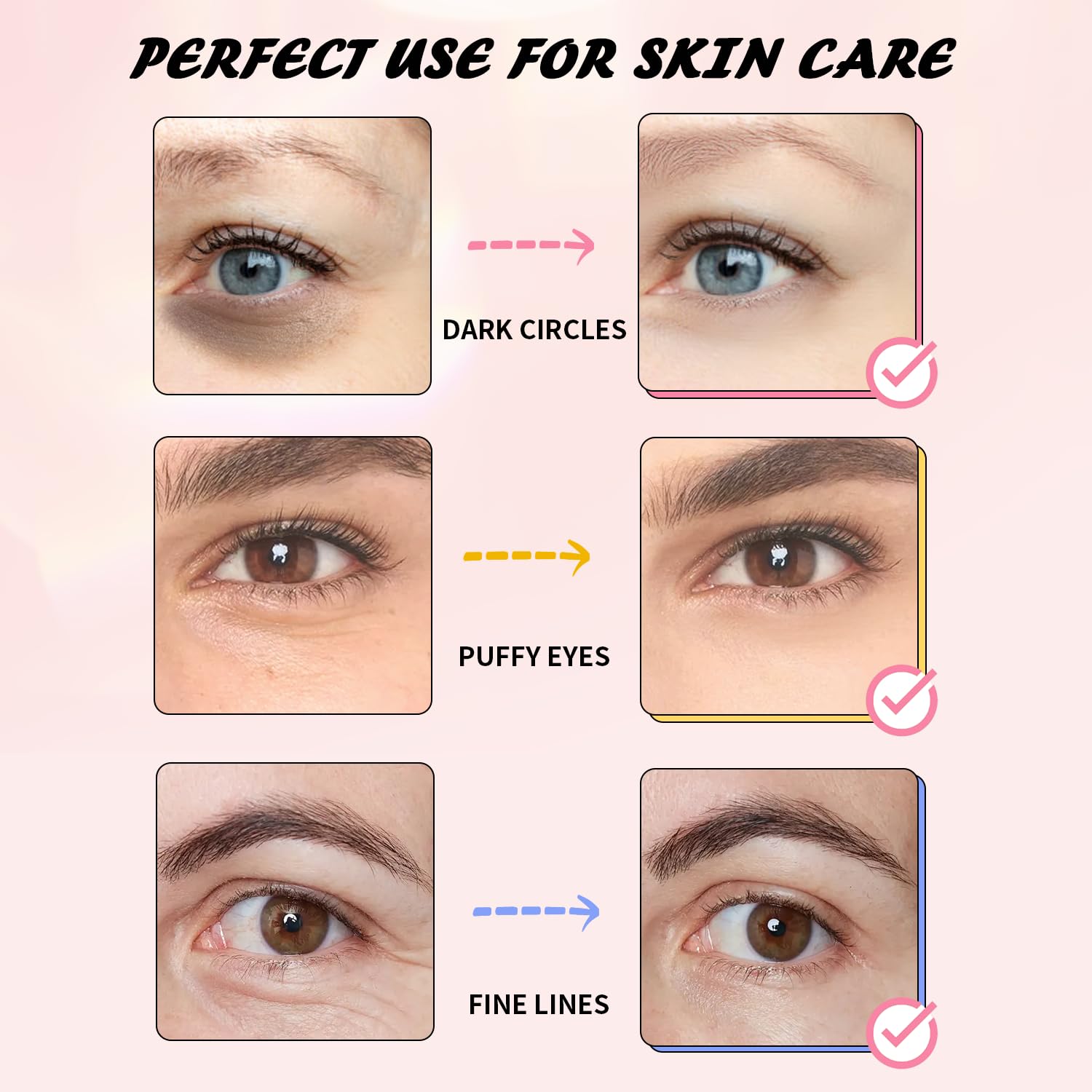 Onespring Eye Masks 24 Pairs – Caffeine, 24K Gold & Retinol Under Eye Patches – Puffy Eyes, Dark Circles & Fine Lines