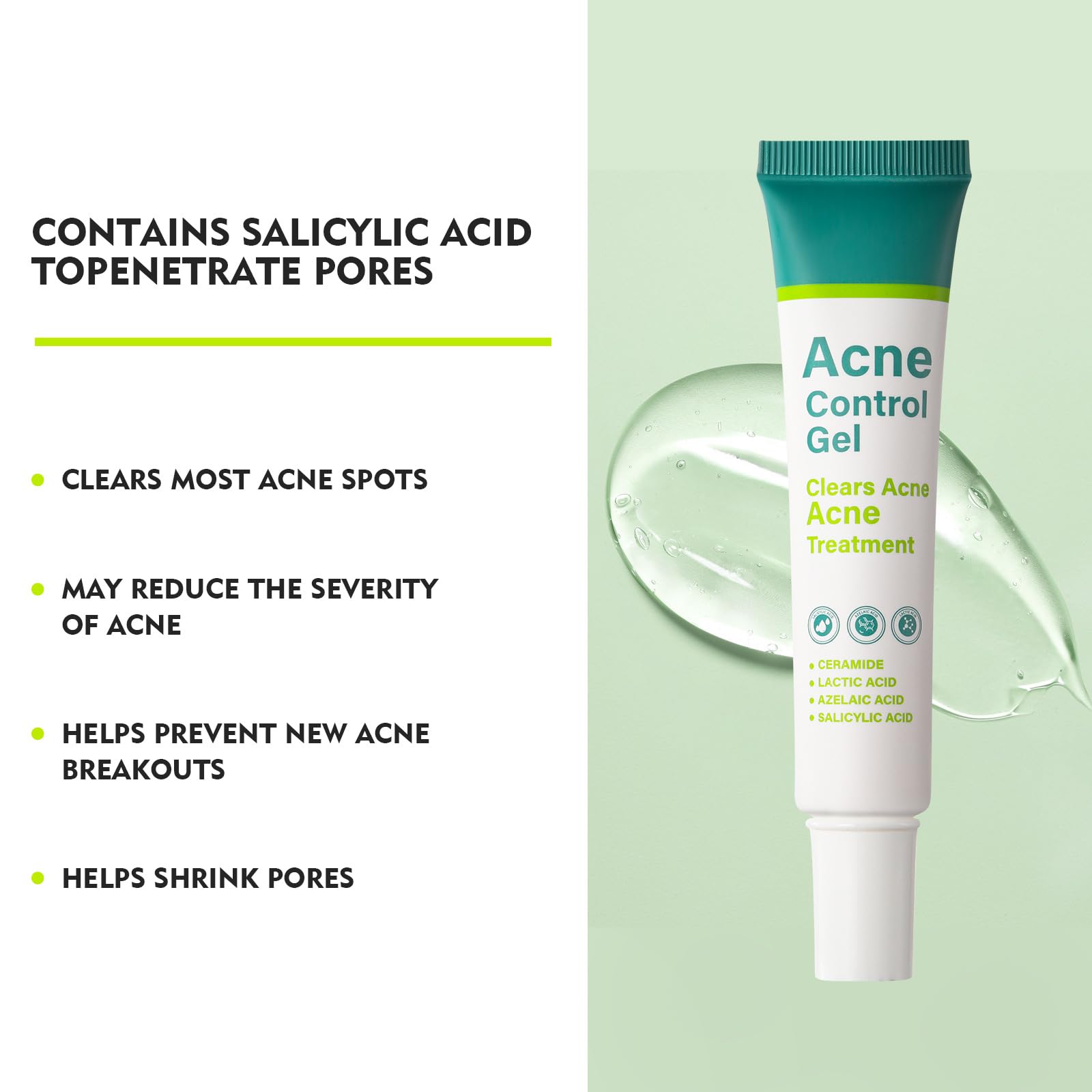 Onkessy Azelaic Acid Serum — 10% Azelaic + Salicylic Acid for Acne & Pore Refinement, 30ml