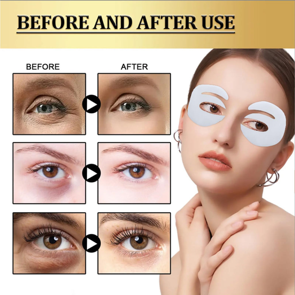 ONMYLOVIN 5 Pairs Deep Collagen Eye Patches – E-Shape Korean Eye Mask for Dark Circles, Hydrating & Firming