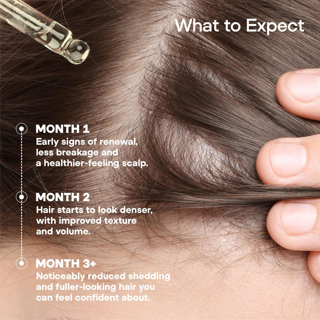 ONYX ProGro LactoPherma Hair Growth Serum – Oil-Free, 12-Ingredient Formula for Regrowth & Thickening