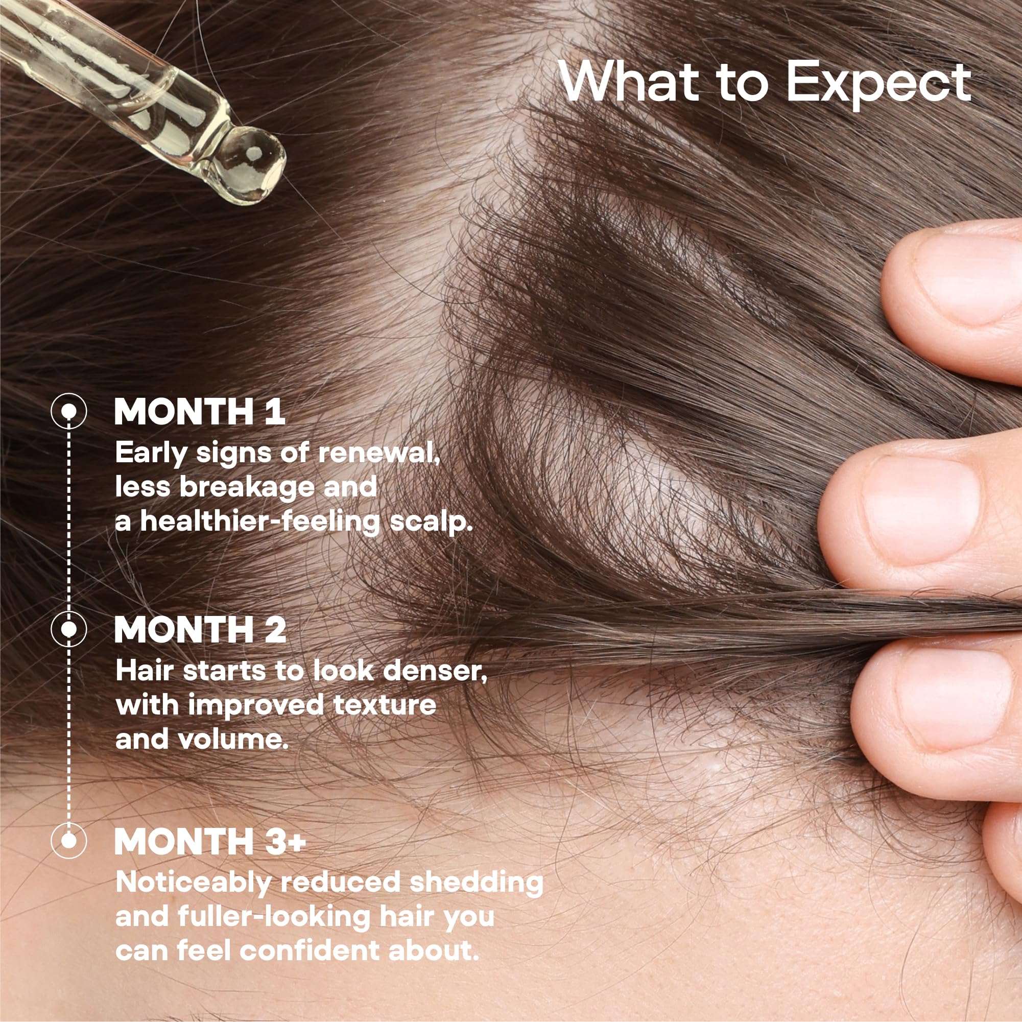 ONYX ProGro LactoPherma Hair Growth Serum – Oil-Free, 12-Ingredient Formula for Regrowth & Thickening