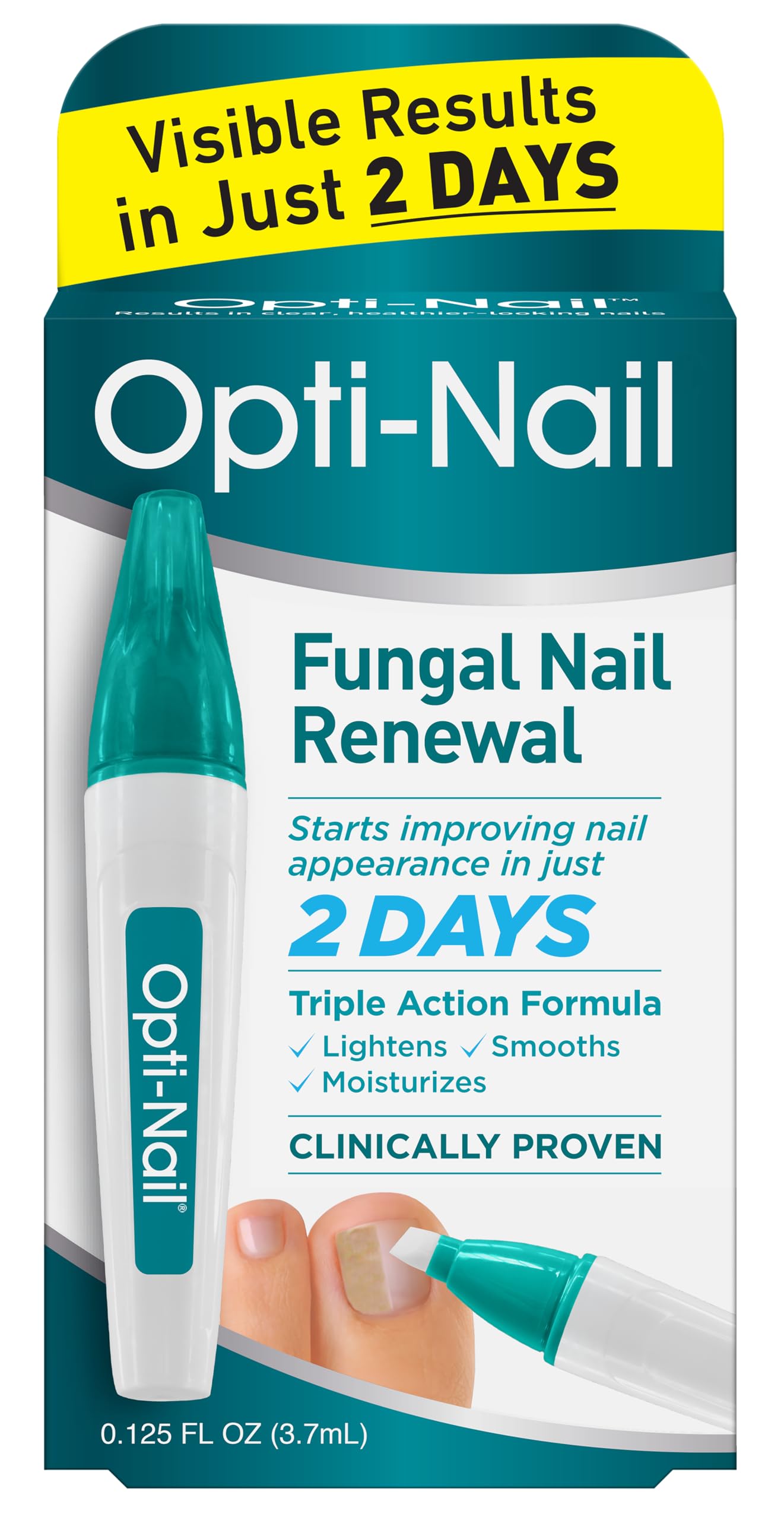 Opti-Nail Fungal Nail Repair Pen – Restore Nail Appearance