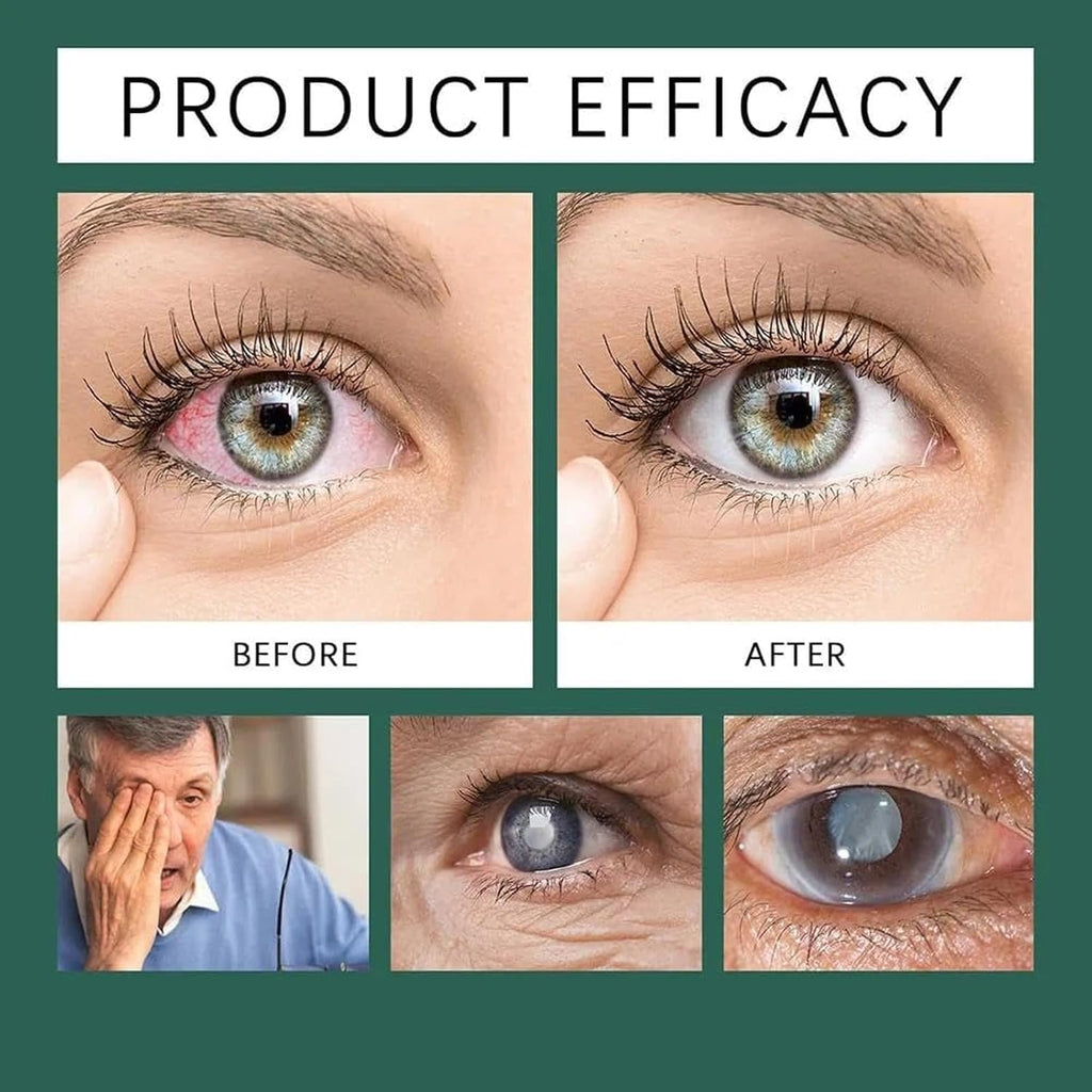 Optifusion Drops & Herbionyx Nano Drop Serum with Lutein and Vitamins C/E — Tear Film Moisture & Comfort