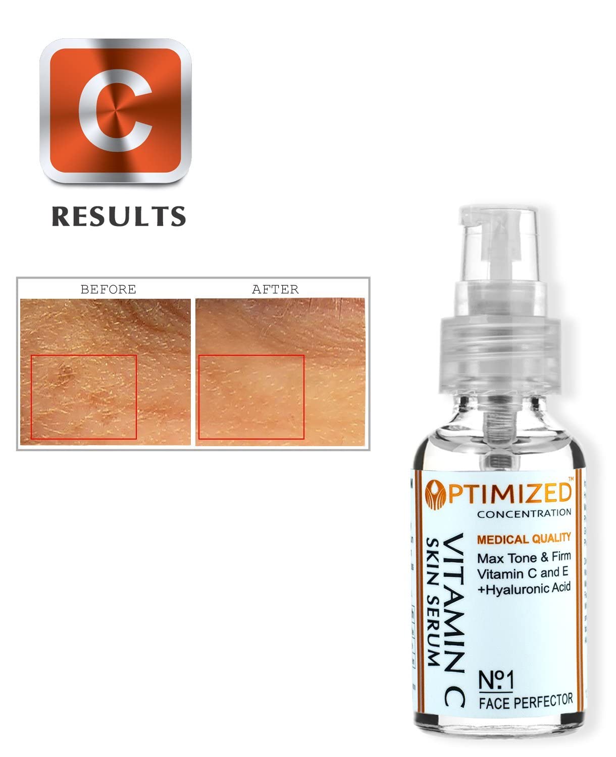 OPTIMIZED Vitamin C Serum with Vitamin E & Hyaluronic Acid – Day Use