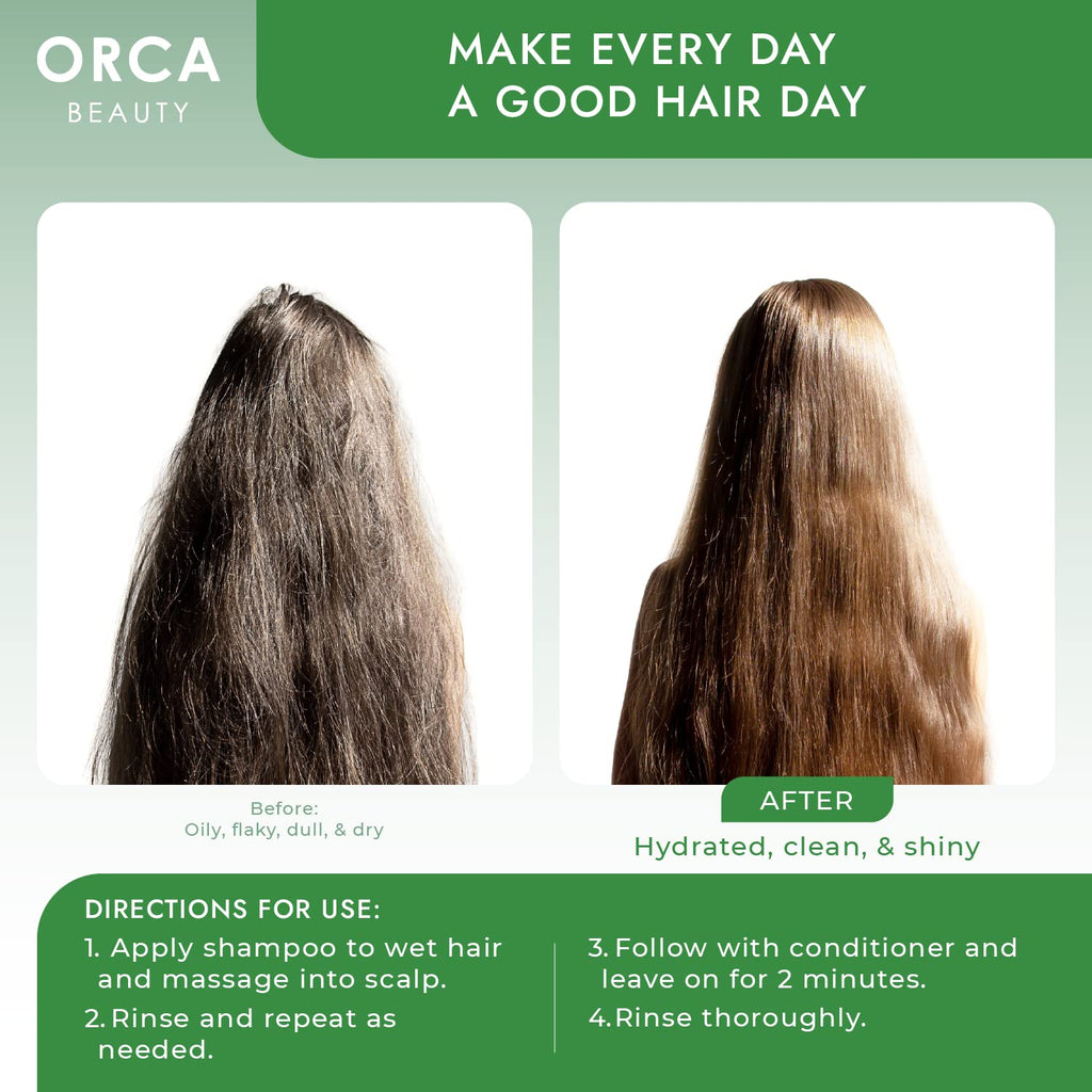 Orca Beauty Tea Tree Shampoo & Conditioner Set 2x16oz – Dandruff Care for Oily Hair