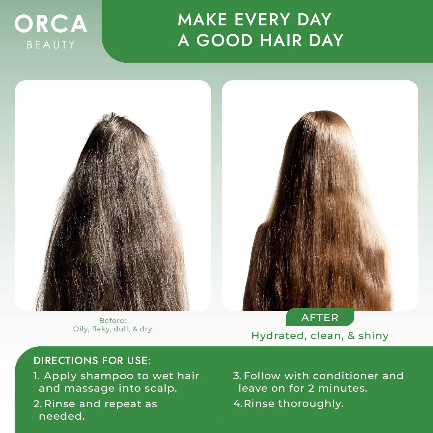 Orca Beauty Tea Tree Shampoo & Conditioner Set 2x16oz – Dandruff Care for Oily Hair