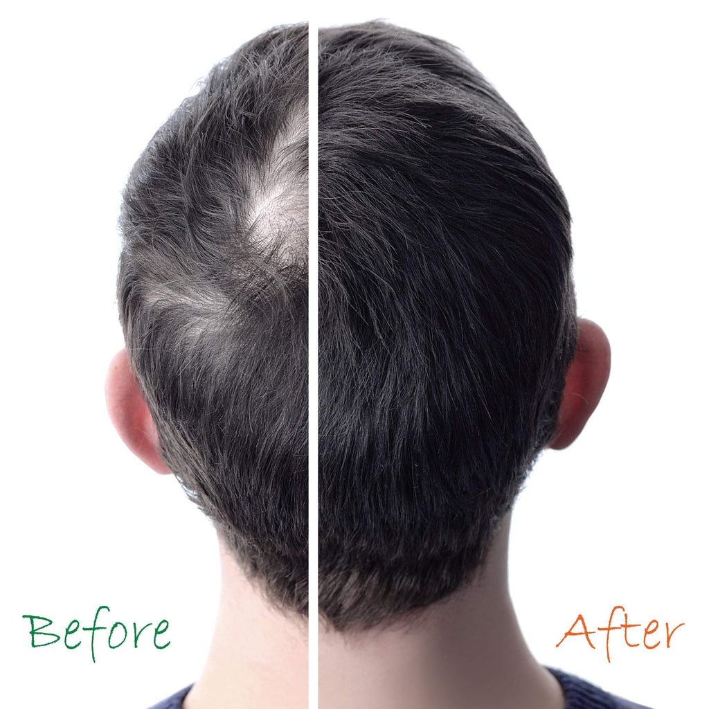 Organic Hair Energizer 2-in-1 Hair Growth Shampoo & Conditioner (13 oz each)