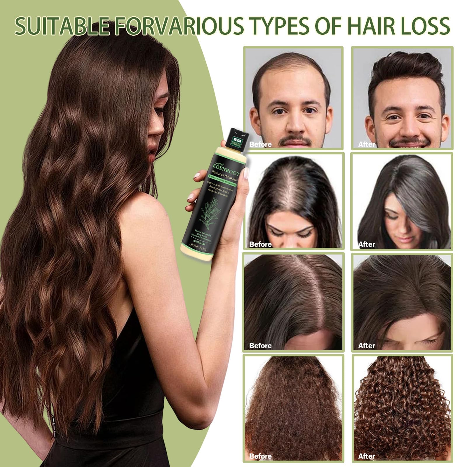Organic Rosemary Hair Growth Shampoo with Hydrolyzed Keratin – Sulfate-Free Volumizing Shampoo for Men & Women (3-Bottle Pack)